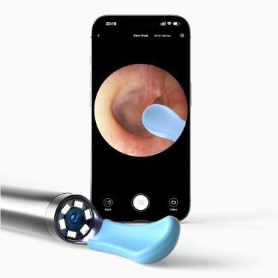 3. Bebird R1+ White | Camera Otoscope for Ear Cleaning | 1080p, 180 mAh