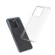 4. Ultra Clear 0.5mm Case for Vivo Y35 / Vivo Y22 / Vivo Y22s Thin Cover Transparent