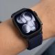 6. Tech-Protect NylonLoop Strap for Apple Watch 44 / 45 / 46 / 49 mm – Navy Blue