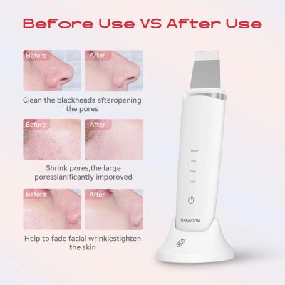 9. MAXGROOM M-169 ultrasonic cavitation peeling device with LED light therapy - white