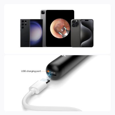 4. Bebird R1+ White | Camera Otoscope for Ear Cleaning | 1080p, 180 mAh