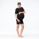 6. Women's ACARIA SHORTS II WMNS Leggings