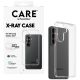 4. CARE by PanzerGlass X-Ray Case for Samsung Galaxy S26+ - Transparent