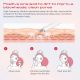8. MAXGROOM M-169 ultrasonic cavitation peeling device with LED light therapy - white