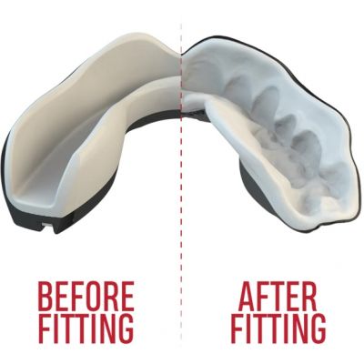 3. OZ-TT "Extro Fangz" Mouthguards Black
