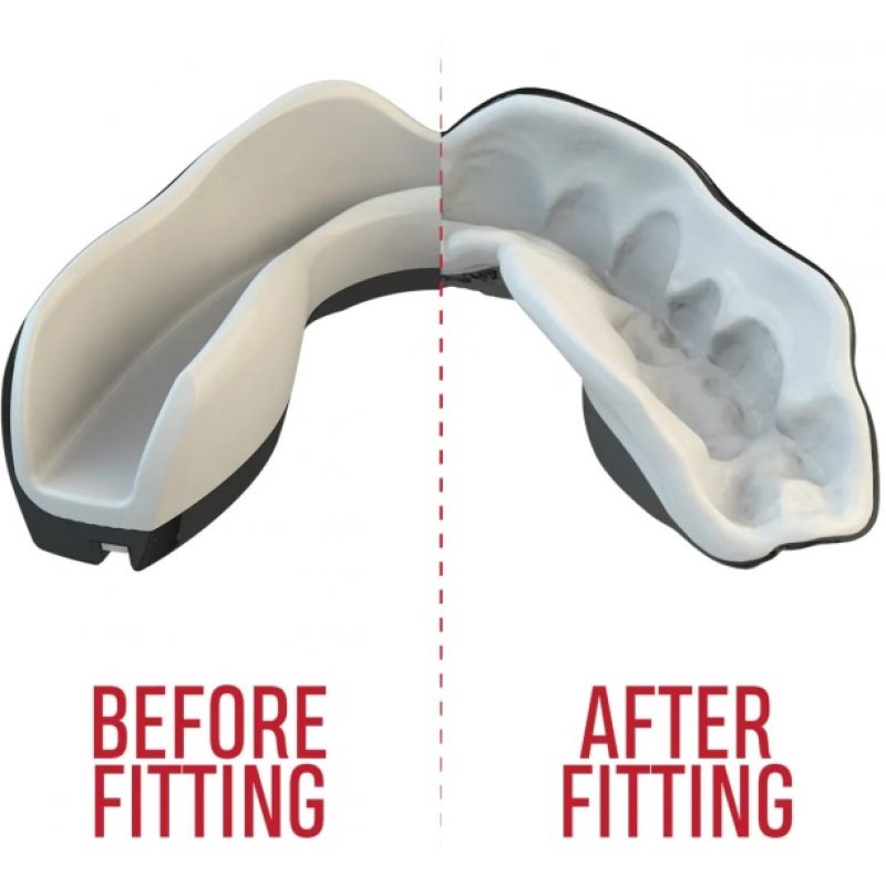 3. OZ-TT "Extro Fangz" Mouthguards Black