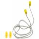 2. ANOMEO Earplugs – PROFESSIONAL