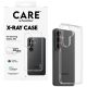 4. CARE by PanzerGlass X-Ray Case for Samsung Galaxy S26 - Transparent