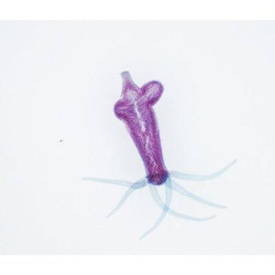 13. Delta Optical Smart 5MP Pro Digital Microscope
